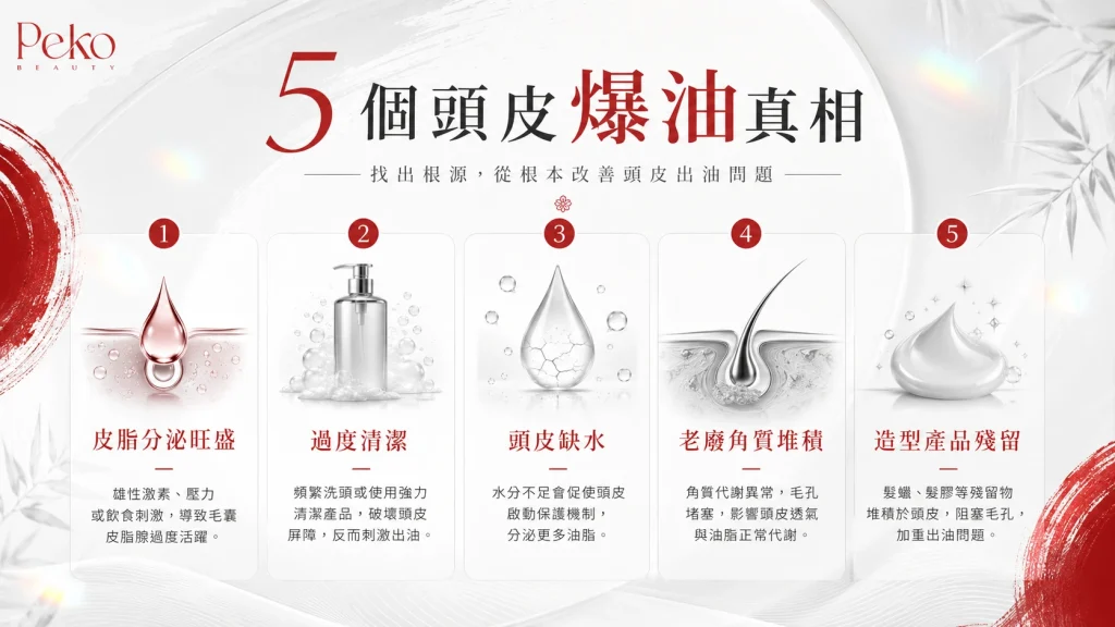 頭油多原因皮脂頭皮缺水角質堆積示意圖