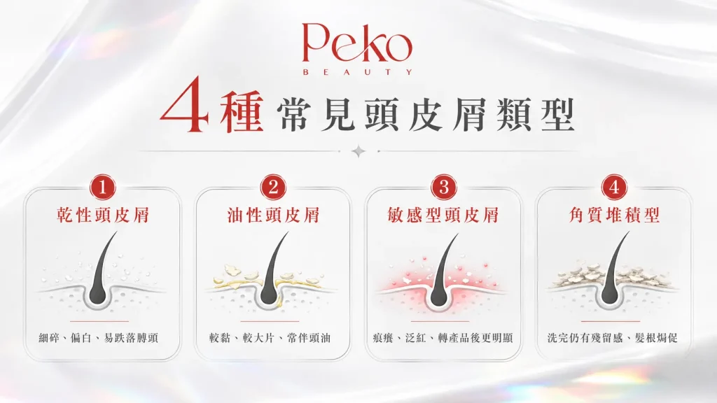 頭皮屑反覆乾性油性敏感角質堆積分別