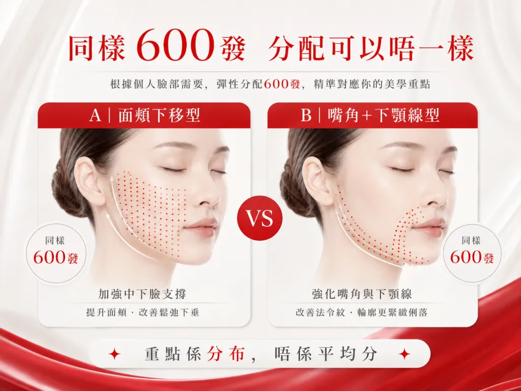 DENSITY 600發按不同面形個人化分布示意