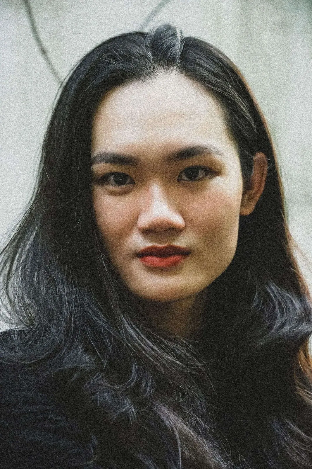 香港女生面部痘印色素分佈示意，紅色痘印同啡黑色痘印對比